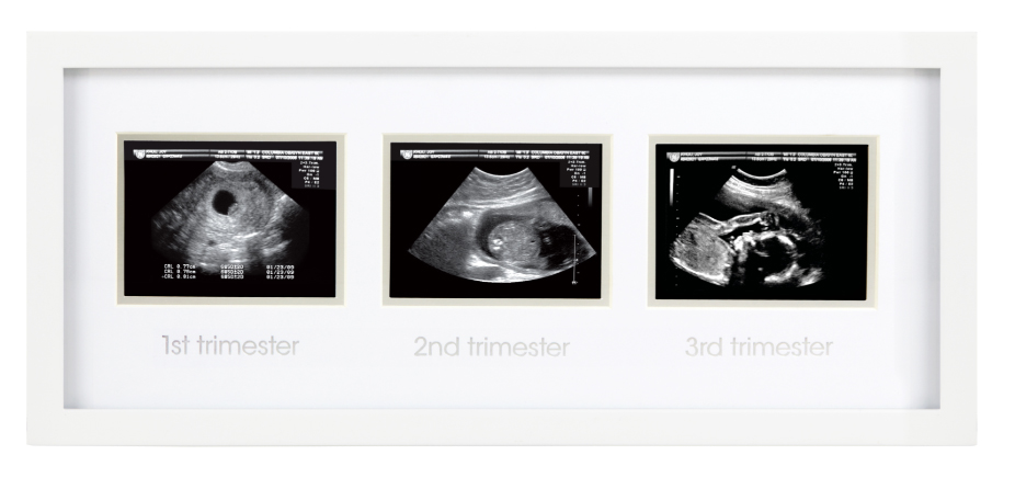 Fotoram för ultraljudsbilder (3 trimestrar)