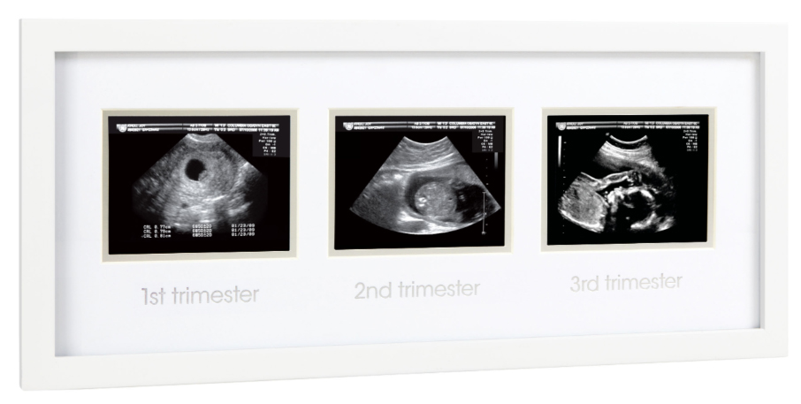 Fotoram för ultraljudsbilder (3 trimestrar)